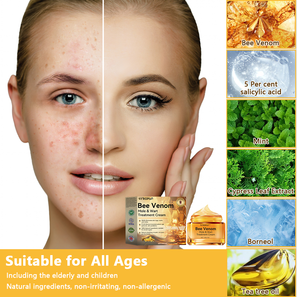 🔥 Only 6 boxes left! We are offering you an additional 50% off! Dermatologist tested, 4-6 sticks are enough to completely repair your skin without recurrence. Don't miss out and wait another year! 💥