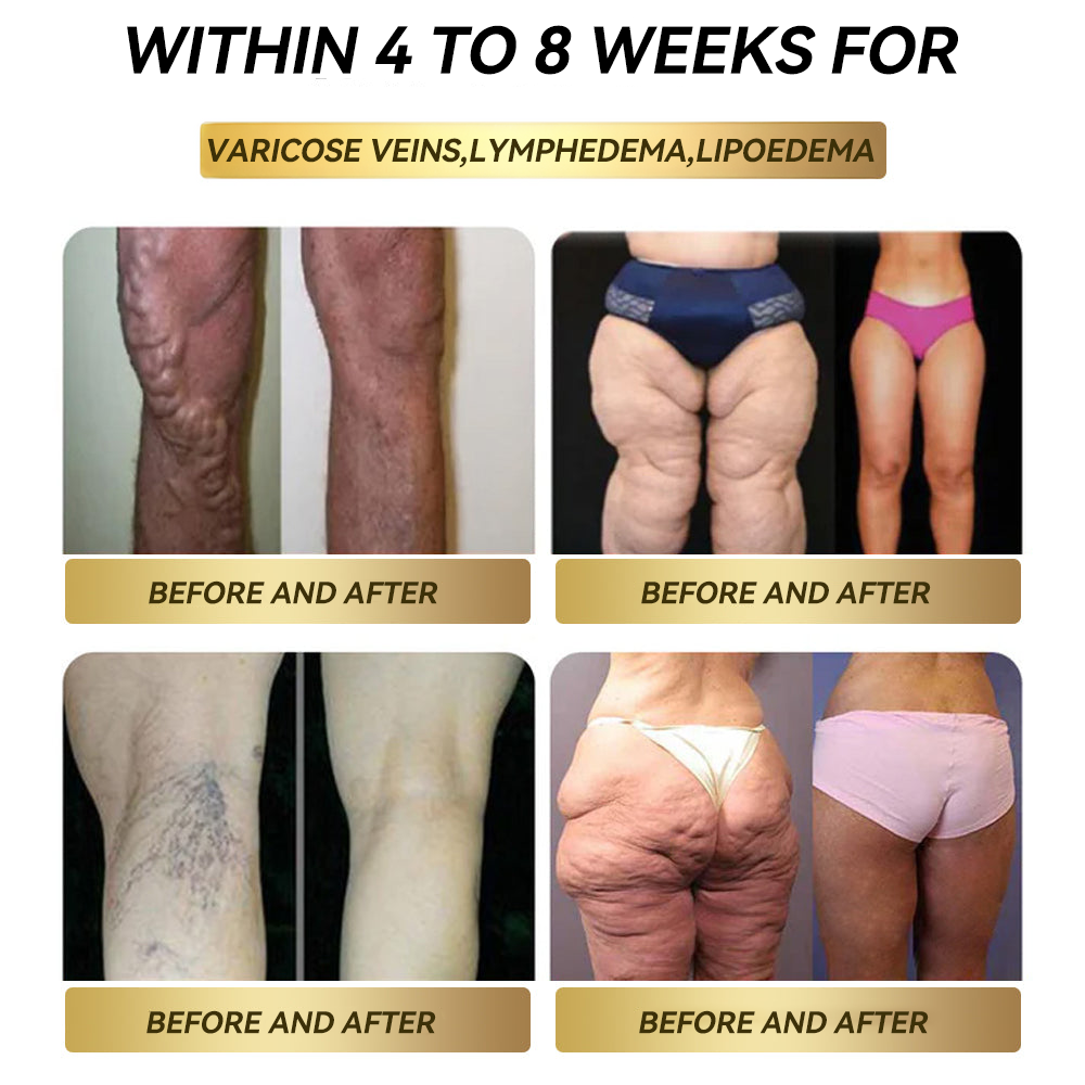 [Visible Results in 7 Days] 💧 𝑭𝑨𝑻𝑶𝑵𝑮® 𝑮𝑳𝑷-1 Fat Burning Drops (Food Grade) — Supports weight management, heart health, metabolism, sleep quality, and joint comfort.
