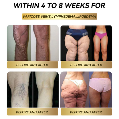 [Visible Results in 7 Days] 💧 𝑭𝑨𝑻𝑶𝑵𝑮® 𝑮𝑳𝑷-1 Fat Burning Drops (Food Grade) — Supports weight management, heart health, metabolism, sleep quality, and joint comfort.