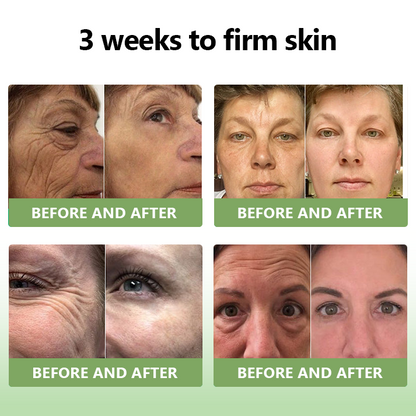 ✅ Official Store: STDEI™ Luxurious Collagen Firming Cream  (FDA-Approved👩‍⚕️) | Tightens Skin, Reduces Wrinkles, Reverses Signs of Aging