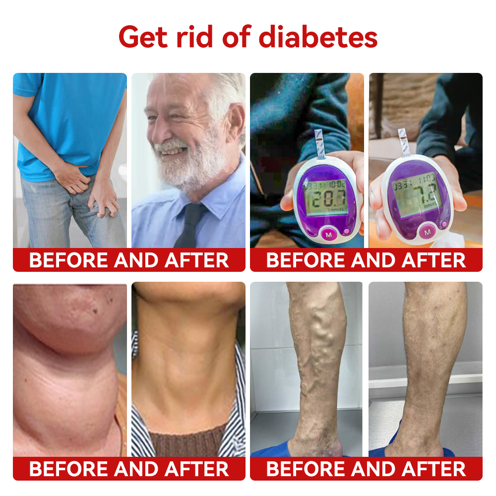 SCNDR™ Slimglutide Metabolic Shaping Drops——Revolutionary GLP-1 Scientific Sugar Control and Weight Loss Programs