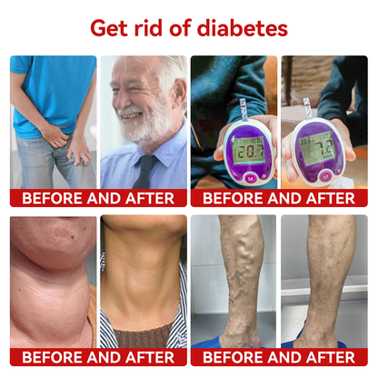 SCNDR™ Slimglutide Metabolic Shaping Drops——Revolutionary GLP-1 Scientific Sugar Control and Weight Loss Programs