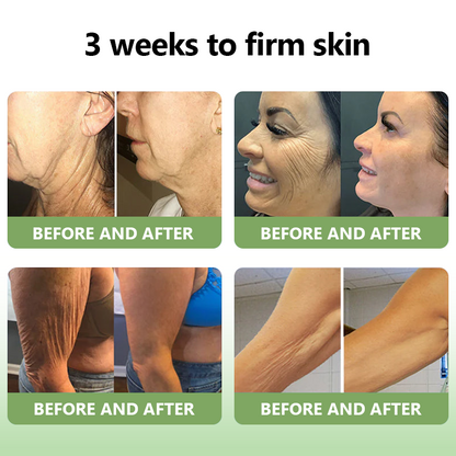 ✅ Official Store: STDEI™ Luxurious Collagen Firming Cream  (FDA-Approved👩‍⚕️) | Tightens Skin, Reduces Wrinkles, Reverses Signs of Aging