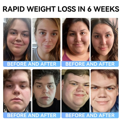 ✅Official Store：𝑺𝐩𝐳𝐯™ ⚡⚡𝐌𝐞𝐠𝐥𝐮𝐭𝐢𝐝𝐞 𝐨𝐫𝐚𝐥 𝐥𝐢𝐪𝐮𝐢𝐝 (A food-grade fat-burning product developed by Albert Einstein College of Medicine and highly recommended by USP!)