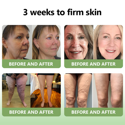 ✅ Official Store: STDEI™ Luxurious Collagen Firming Cream  (FDA-Approved👩‍⚕️) | Tightens Skin, Reduces Wrinkles, Reverses Signs of Aging