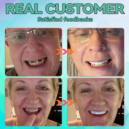 𝐁𝐢𝐤𝐞𝐧𝐝𝐚™ 𝐒𝐢𝐥𝐢𝐜𝐨𝐧𝐞 𝐑𝐞𝐥𝐢𝐧𝐞 𝐃𝐞𝐧𝐭𝐮𝐫𝐞 𝐒𝐞𝐭 🍀(🦷𝐋𝐢𝐦𝐢𝐭𝐞𝐝 𝐭𝐢𝐦𝐞 𝐝𝐢𝐬𝐜𝐨𝐮𝐧𝐭 𝐋𝐚𝐬𝐭 𝟑𝟎 𝐦𝐢𝐧𝐮𝐭𝐞𝐬🦷)