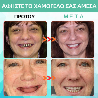 𝐁𝐢𝐤𝐞𝐧𝐝𝐚™ 𝐒𝐢𝐥𝐢𝐜𝐨𝐧𝐞 𝐑𝐞𝐥𝐢𝐧𝐞 𝐃𝐞𝐧𝐭𝐮𝐫𝐞 𝐒𝐞𝐭 🌍(🦷𝐋𝐢𝐦𝐢𝐭𝐞𝐝 𝐭𝐢𝐦𝐞 𝐝𝐢𝐬𝐜𝐨𝐮𝐧𝐭 𝐋𝐚𝐬𝐭 𝟑𝟎 𝐦𝐢𝐧𝐮𝐭𝐞𝐬🦷)
