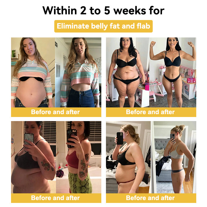 𝑺𝑷𝒁𝑽™ 👩‍⚕️🎁 𝑩𝒆𝒆 𝑽𝒆𝒏𝒐𝒎 𝑰𝒏𝒕𝒆𝒔𝒕𝒊𝒏𝒂𝒍 𝑫𝒆𝒕𝒐𝒙 𝑺𝒍𝒊𝒎𝒎𝒊𝒏𝒈 𝑪𝒓𝒆𝒂𝒎（For all obesity and lymphatic problems）