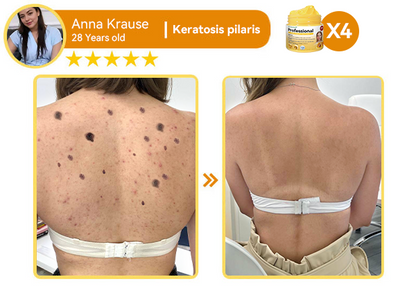 ✅ 𝐃𝐨𝐫𝐦𝐨𝐫𝐧𝐚™ 𝐏𝐫𝐨𝐟𝐞𝐬𝐬𝐢𝐨𝐧𝐚𝐥 𝐌𝐮𝐥𝐭𝐢-𝐏𝐮𝐫𝐩𝐨𝐬𝐞 𝐂𝐚𝐫𝐞 𝐂𝐫𝐞𝐚𝐦 – 𝐃𝐞𝐯𝐞𝐥𝐨𝐩𝐞𝐝 𝐛𝐲 𝐌𝐚𝐲𝐨 𝐂𝐥𝐢𝐧𝐢𝐜 & 𝐑𝐞𝐜𝐨𝐠𝐧𝐢𝐳𝐞𝐝 𝐛𝐲 𝐭𝐡𝐞 𝐀𝐦𝐞𝐫𝐢𝐜𝐚𝐧 𝐀𝐜𝐚𝐝𝐞𝐦𝐲 𝐨𝐟 𝐃𝐞𝐫𝐦𝐚𝐭𝐨𝐥𝐨𝐠𝐲 (𝐀𝐀𝐃)